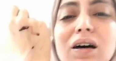 طبيبة أسنان شبرا الخيمة